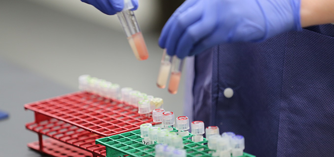 serology samples in rack